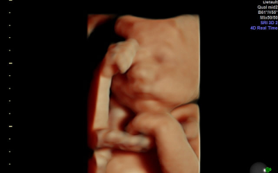 Amazing Ultrasound Photos